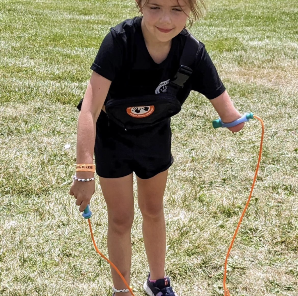 A young girl with a limb difference wearing a black t-shirt and shorts uses a jump rope on a field with a blue EasyHold universal cuff strapping the handle to her limb.